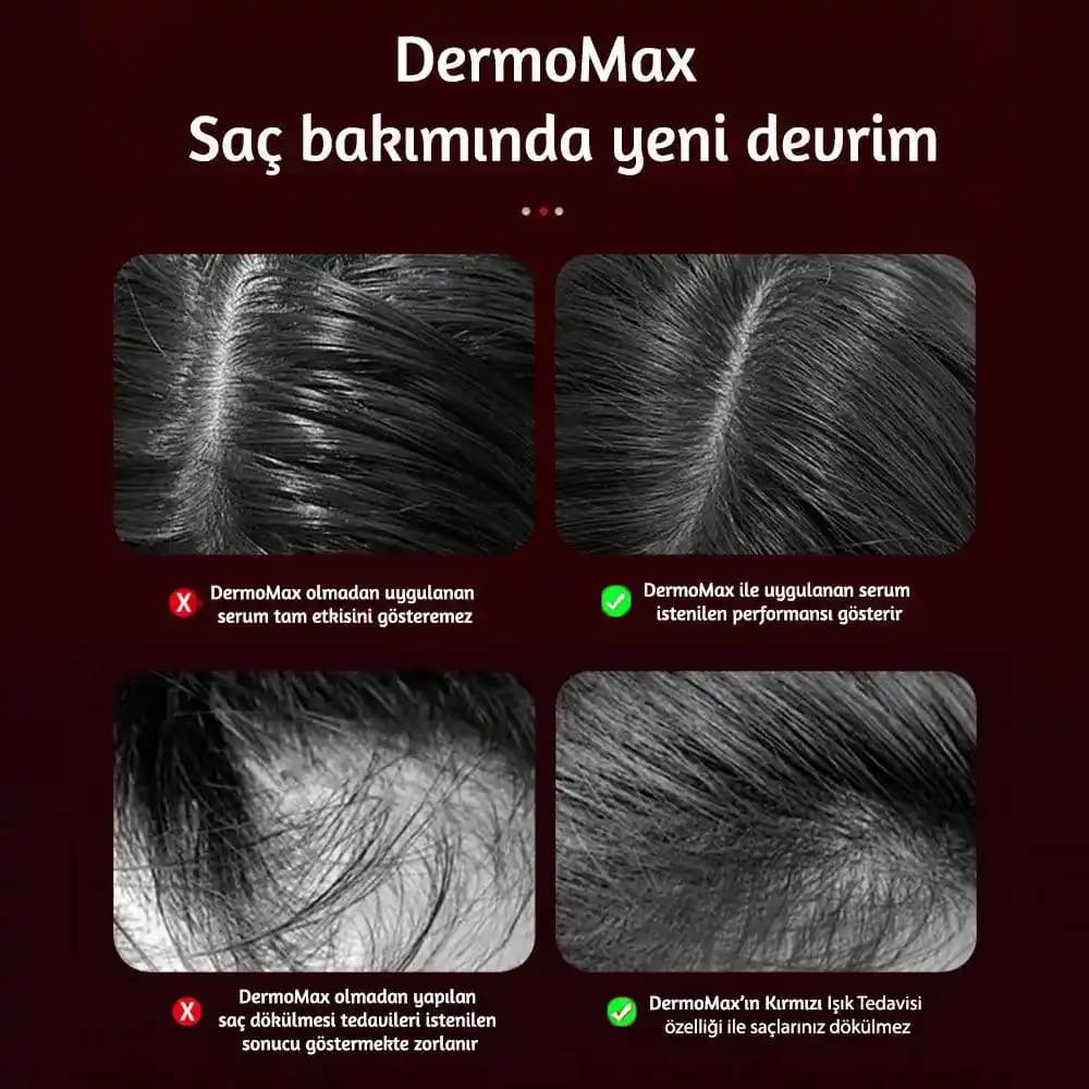 Dermomax Akıllı Tarak Nedir, Özellikleri ve Güncel Durumu Hakkında Bilgi