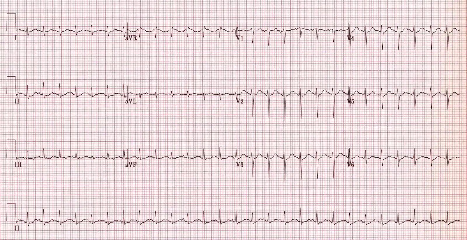 Evil Sine Wave ve Diyot Kırpma Devrelerinin Ses Elektroniğindeki Teknik İncelemesi