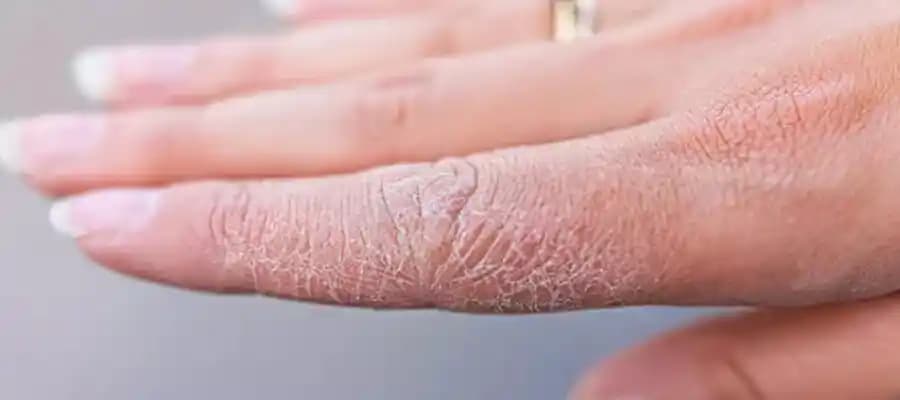 Nemlendiricilerin Sağlık Faydaları ve Düzenli Bakımın Önemi Üzerine Kapsamlı İnceleme