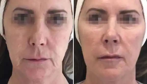 Elektronik Dünyasında Profilo Kavramı ve Güvenli Kullanım Yöntemleri