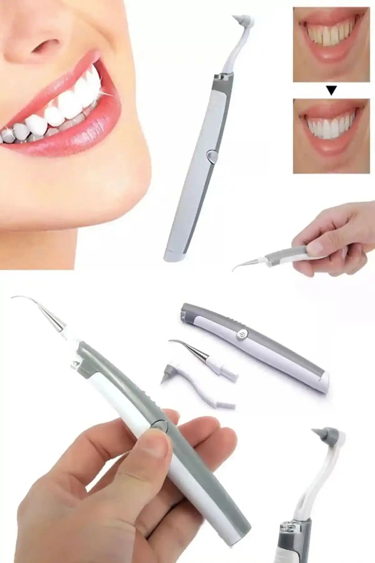 Elektronik Tartarı Temizleme Aletleri: Diş Sağlığında Yenilikçi ve Güvenli Çözümler